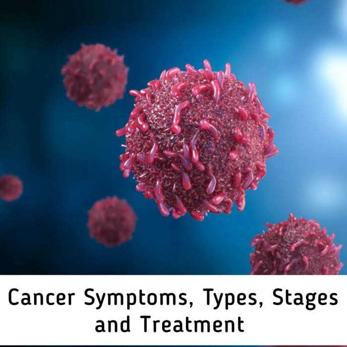 Cancer: Symptoms, Stages, Types and Treatment